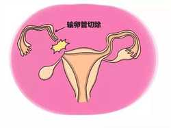 女性买精子可不可以怀孕,买精生子在中国合法吗？未婚女性可以买精生子吗？