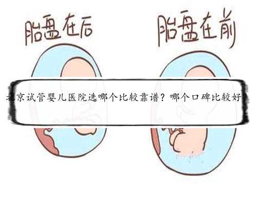 北京试管婴儿医院选哪个比较靠谱？哪个口碑比较好？